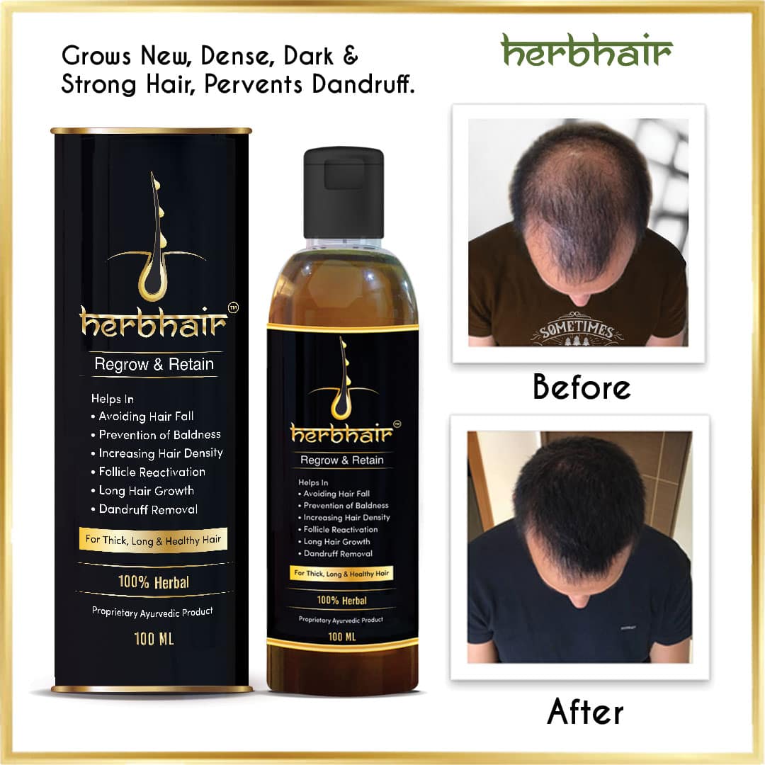 Herbhair Pure Herbal Hair Regrowth And Retention Oil